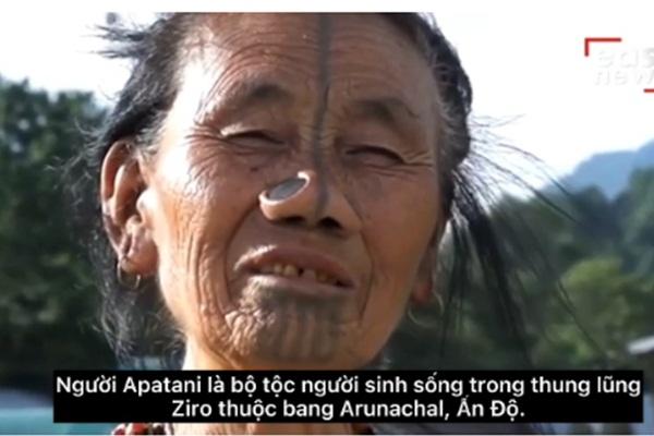 Sao nữ dưỡng da bằng máu người, giờ run sợ vì nguy cơ nhiễm HIV-5