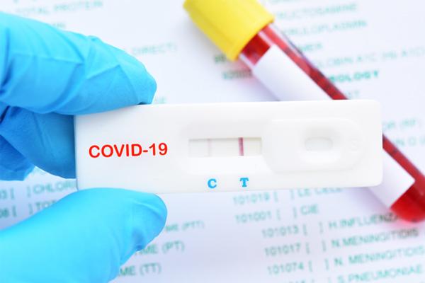 Biến thể họ hàng của Delta gây lo ngại vì có dấu hiệu lan rộng-1