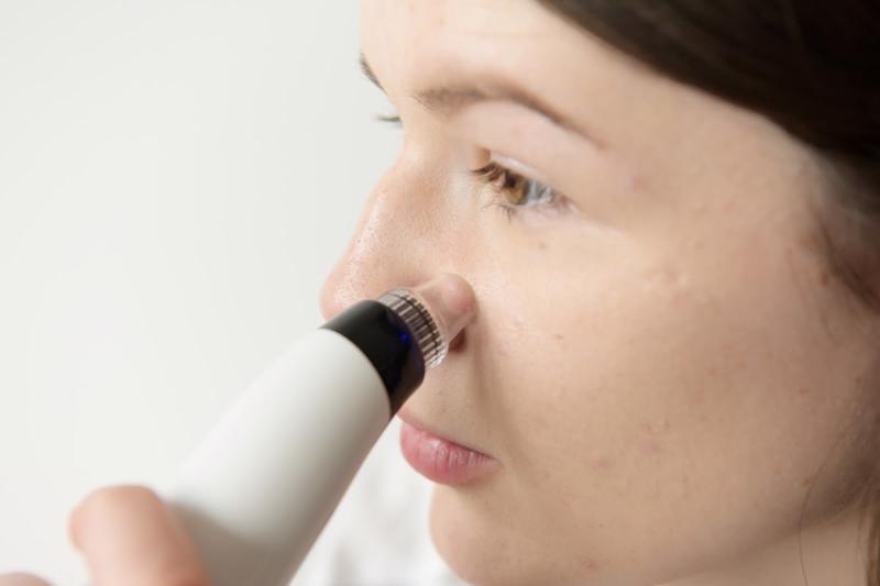 HHen Niê để lộ gương mặt nhiều vết thâm tím như bị bạo hành-3