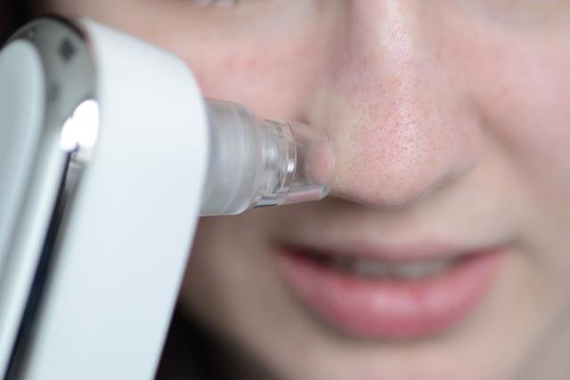 HHen Niê để lộ gương mặt nhiều vết thâm tím như bị bạo hành-5