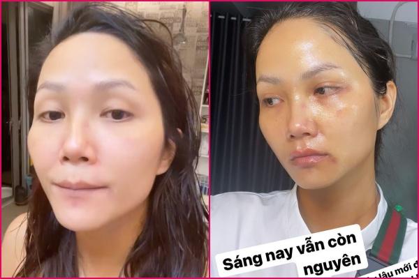 HHen Niê xỉu ngang vì chụp ảnh chán chê mới phát hiện mặc váy trái-6