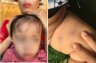 Vụ bé gái 2 tuổi bị bạn học đánh: Sẽ đóng cửa cơ sở nếu sai phạm