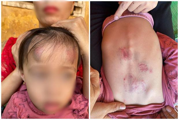 Vụ bé gái 2 tuổi bị bạn học đánh: Sẽ đóng cửa cơ sở nếu sai phạm-1
