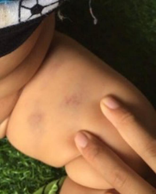 Vụ bé gái 2 tuổi bị bạn học đánh: Sẽ đóng cửa cơ sở nếu sai phạm-2