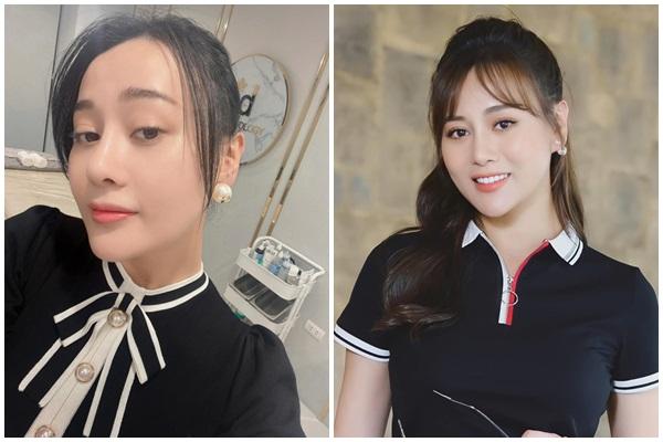 Da nát tan vì tin vào lọ serum tá công dụng, bác sĩ đưa lời khuyên-3