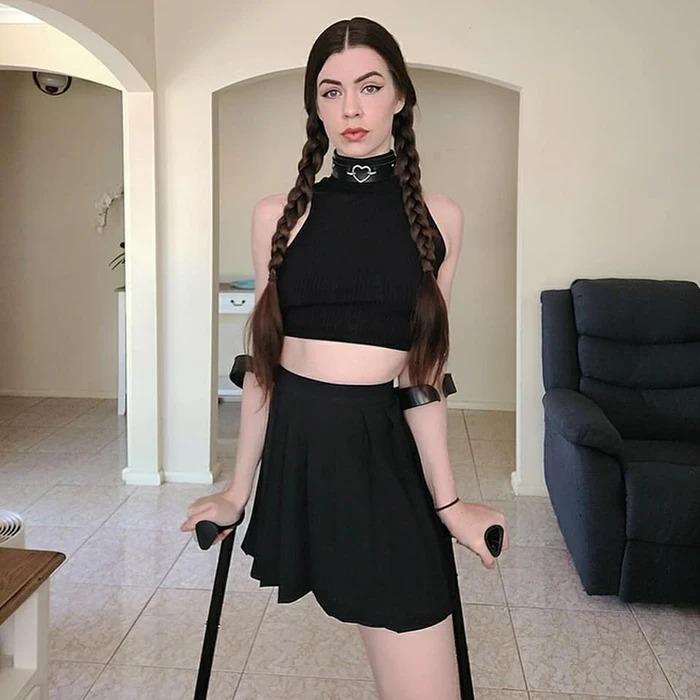 Cô gái cụt chân trở thành mẫu nổi tiếng và câu chuyện truyền cảm hứng-2