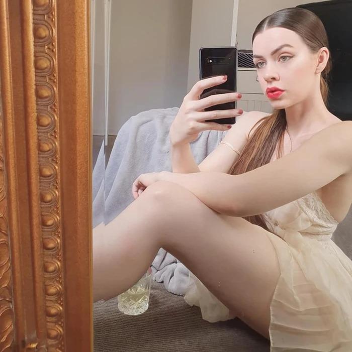 Cô gái cụt chân trở thành mẫu nổi tiếng và câu chuyện truyền cảm hứng-4