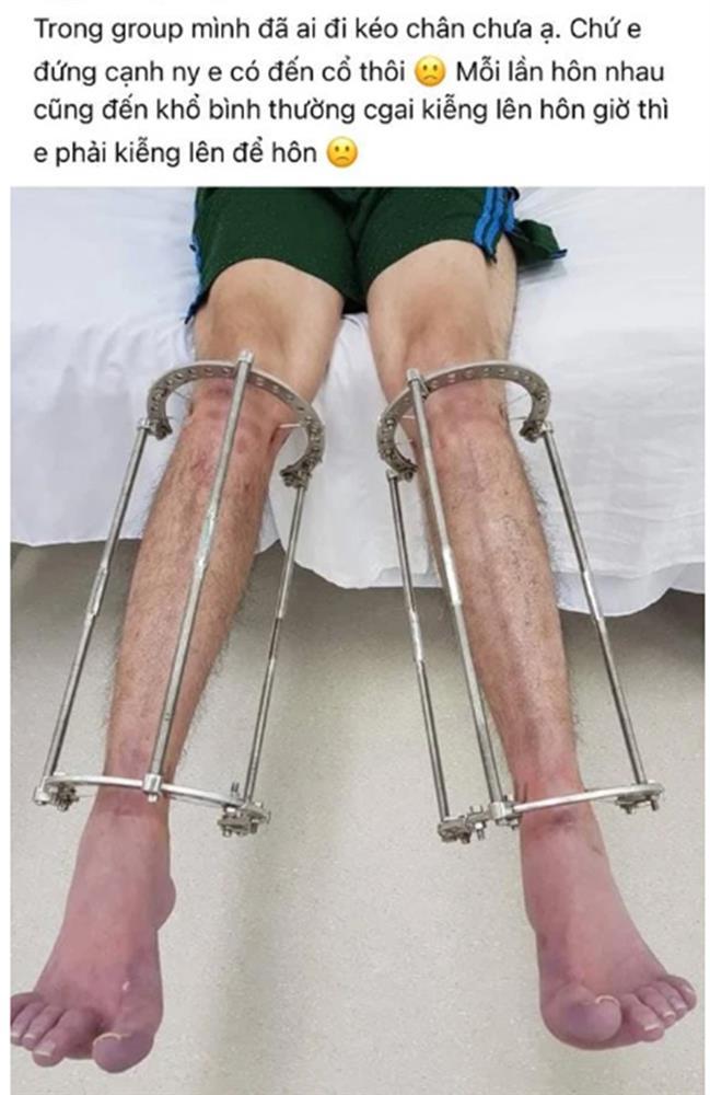 Nam thanh niên cao đến cổ bạn gái, đòi đi kéo chân cho vừa tầm hôn-1