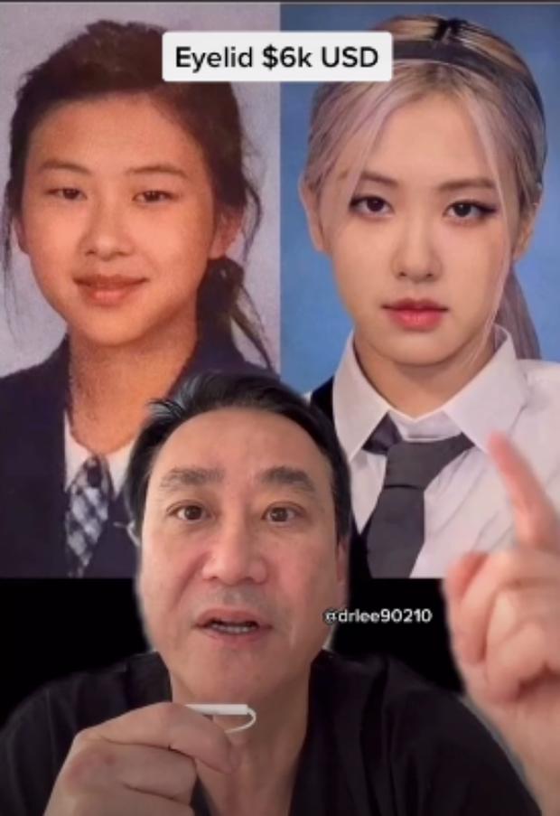 Bác sĩ khẳng định Rosé dao kéo 2 bộ phận, tổng thiệt hại nửa tỷ-2