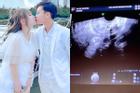 Lộ ảnh siêu âm thai của cặp đồng tính nữ Bi Bảo - Múi Xù