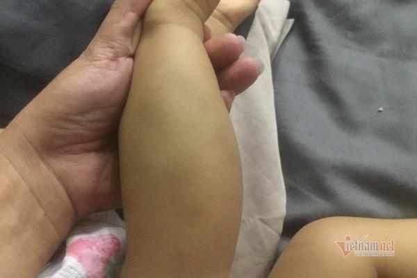 Bé 16 tháng nghi bị bạo hành: Người nhận nuôi nói gì?-2