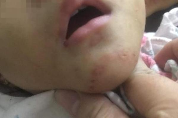 Cô giáo mầm non dùng băng dính quấn trẻ vào chăn, làm gối gác chân-2