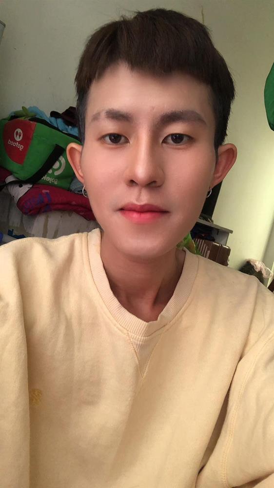 Sao nam Vbiz nguy kịch vì viêm gan B và suy dinh dưỡng nặng-9