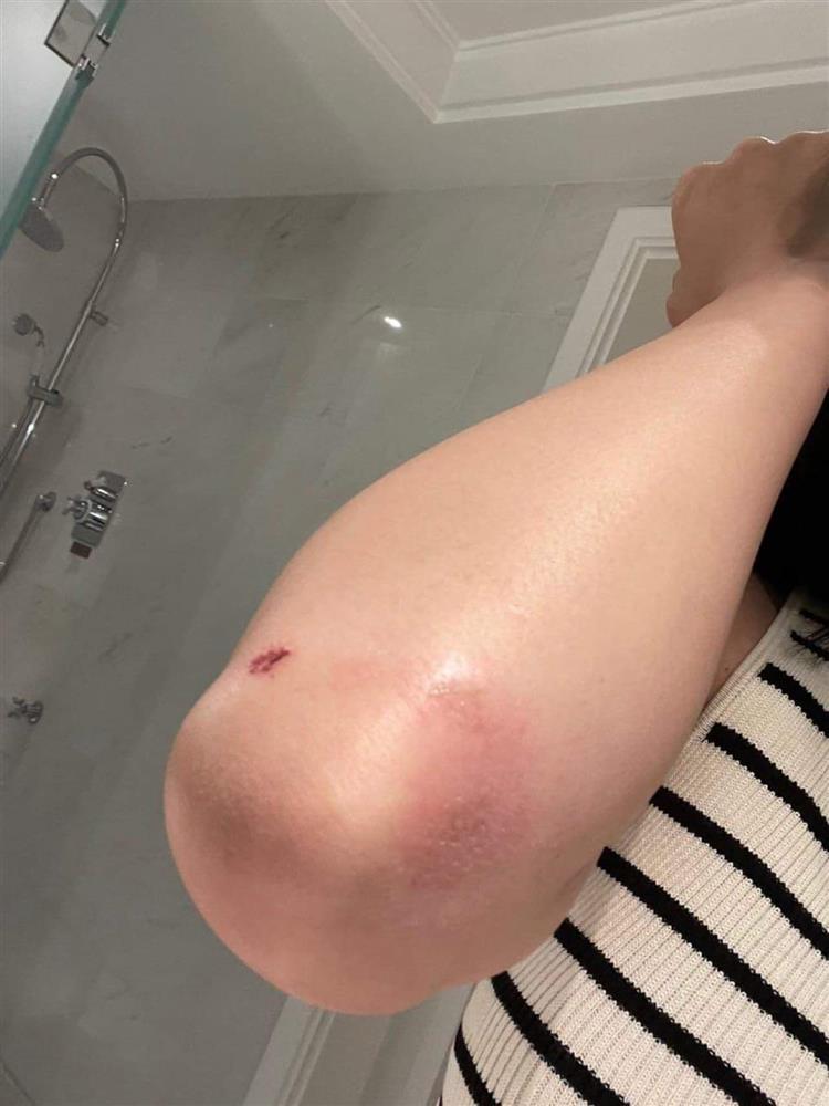 Lily Chen tung ảnh bị hành hung, ám chỉ nữ hoàng nội y?-2
