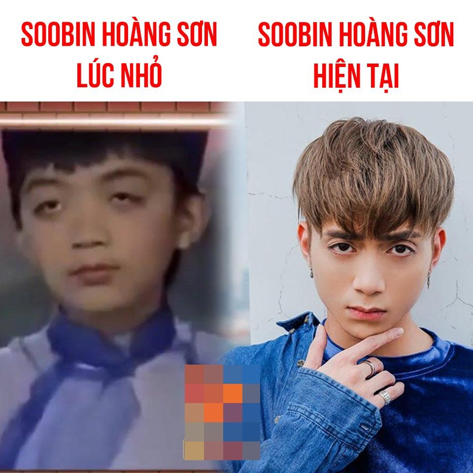 Ảnh thời nhỏ tố cáo Soobin Hoàng Sơn can thiệp dao kéo?-2