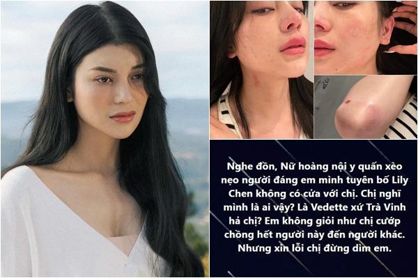 Lily Chen ám chỉ người yêu cô đã bị nữ hoàng nội y chốt xong xuôi?-5