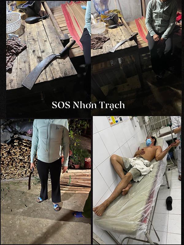 Đi nhậu về đánh đập vợ con, chồng bị vợ vác rựa bổ vào đầu-1