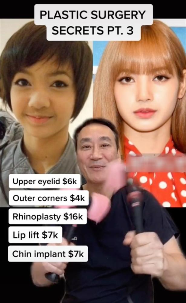 Bác sĩ khẳng định BLACKPINK dao kéo, riêng Lisa sửa mặt gần 1 tỷ?-1