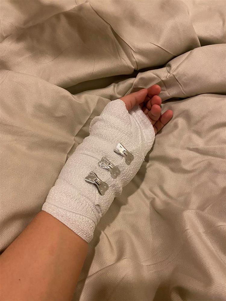 Lương Minh Trang lộ cằm nhọn hoắt, sút 10kg hậu ly hôn Vinh Râu-10