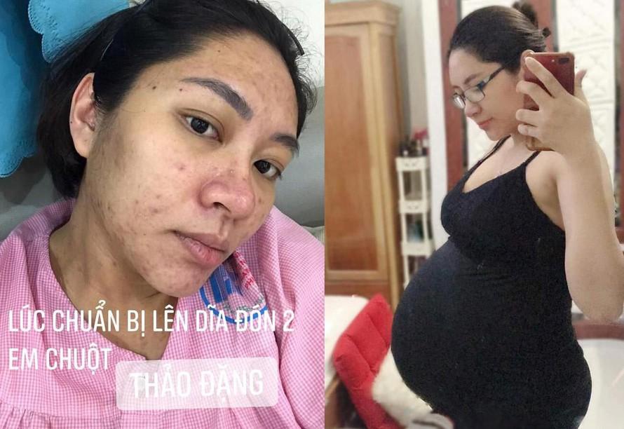 Đặng Thu Thảo: Tôi từng chết lâm sàng, sợ chồng cũ trả thù-2