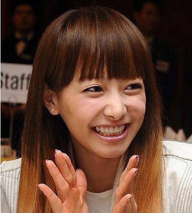 Những mỹ nhân Cbiz có nụ cười hết ga siêu xấu-9