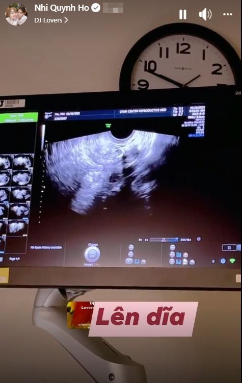 Gái xinh nức tiếng giới LGBT lộ bụng lùm lùm-5