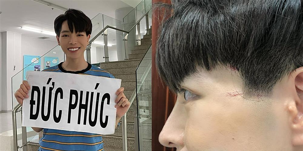 Lan Ngọc chân đầy hoa gấm vì lăn xả Running Man, nhìn mà xót!-5