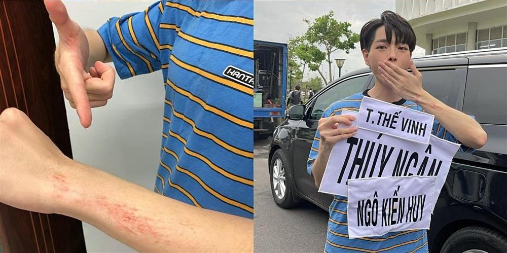 Lan Ngọc chân đầy hoa gấm vì lăn xả Running Man, nhìn mà xót!-6