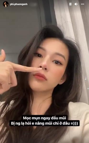 Hết nghi nâng ngực bơm môi, Phí Phương Anh lại bị hỏi sửa mũi-2