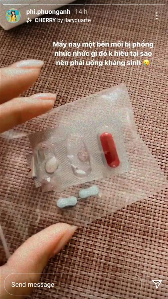 Hết nghi nâng ngực bơm môi, Phí Phương Anh lại bị hỏi sửa mũi-3