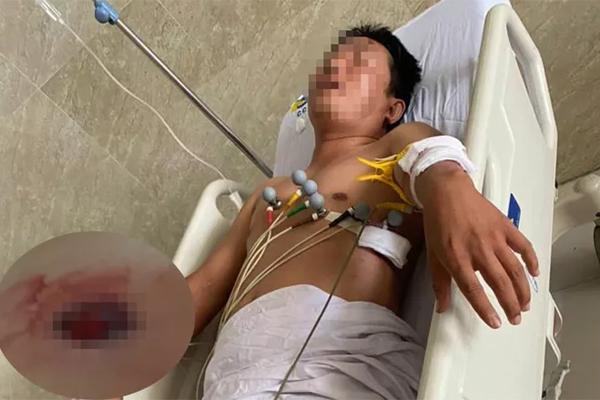 Thách đối phương bắn đi, người đàn ông bị bắn liền 4 phát nguy kịch-1
