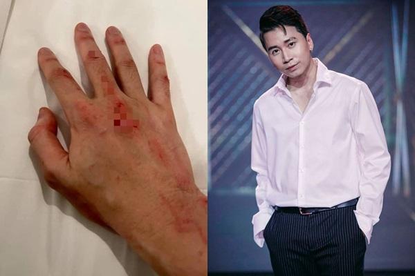 Karik ghi hình vòng 2 Rap Việt với bàn tay băng bó-5