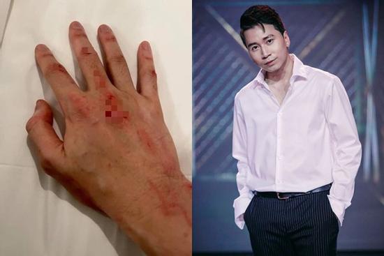 Karik gây lo lắng với bức ảnh chụp bàn tay trầy xước dính máu