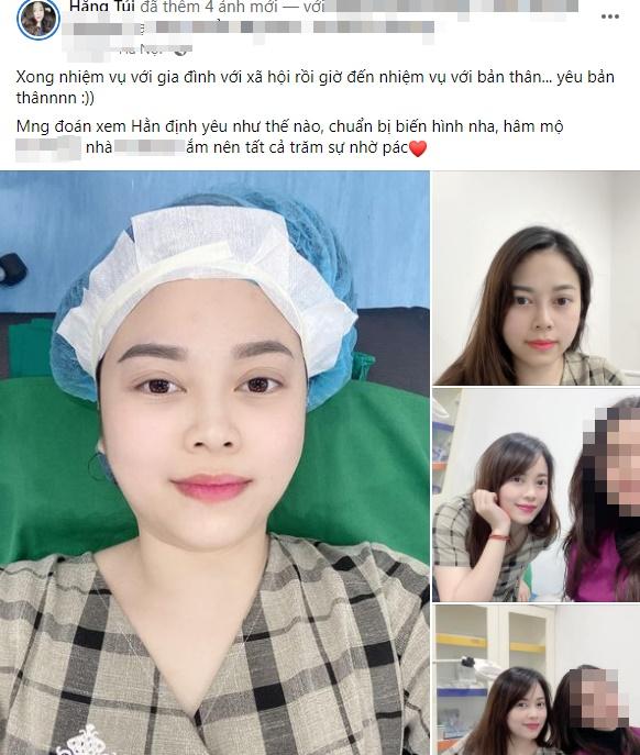 Giật mình diện mạo mẹ 6 con Hằng Túi sau hơn 1 năm thẩm mỹ-6