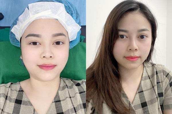 Hằng Túi sửa sang mặt mũi sau 5 lần chửa đẻ-2