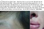 Đối tượng đánh dã man phụ nữ ở Hà Nội từng là võ sinh-2