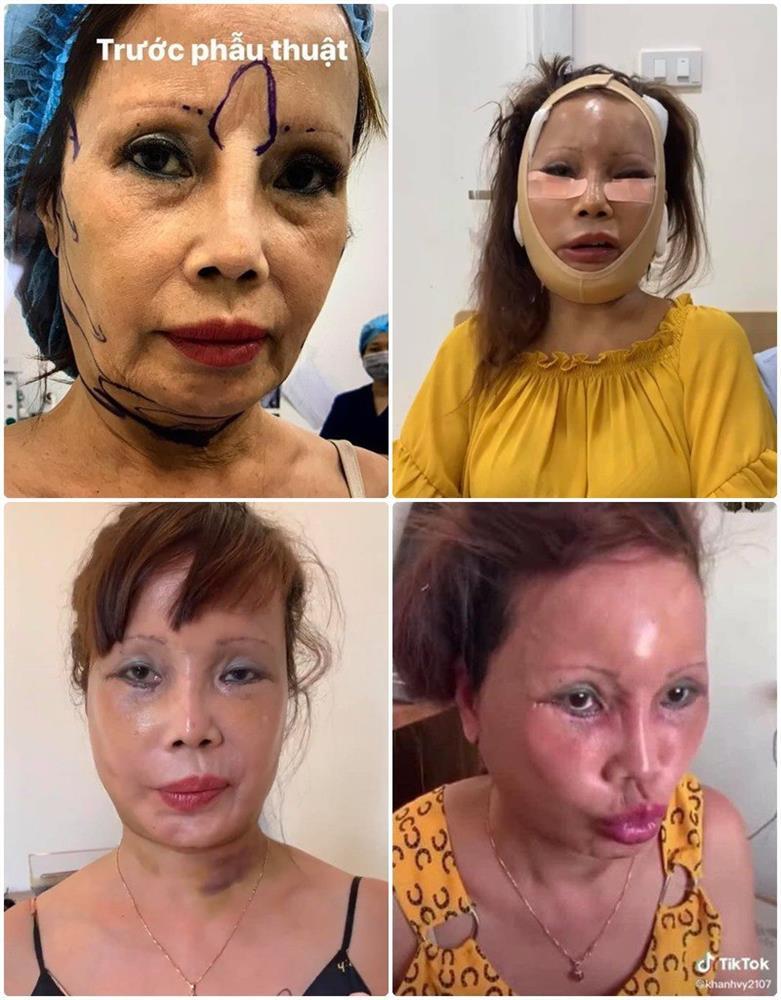 Cô dâu 62 tuổi sửa 1 điểm trẻ hẳn ra, xứng đôi cùng chồng ra phết!-7