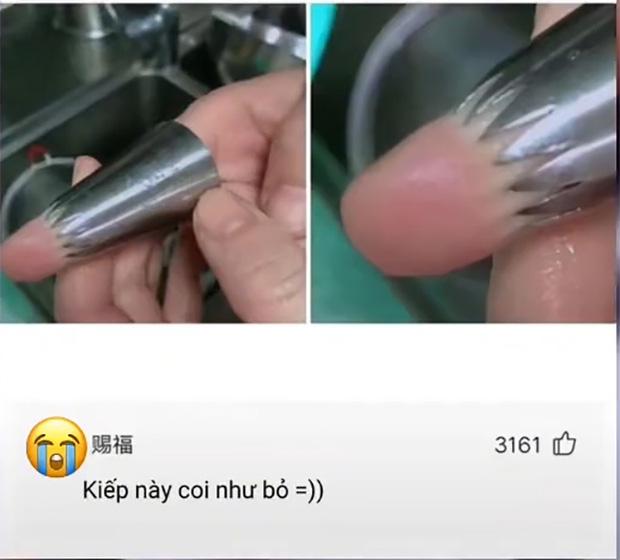 Thanh niên suýt mất ngón tay chỉ vì nghịch ngợm khi làm bánh-2