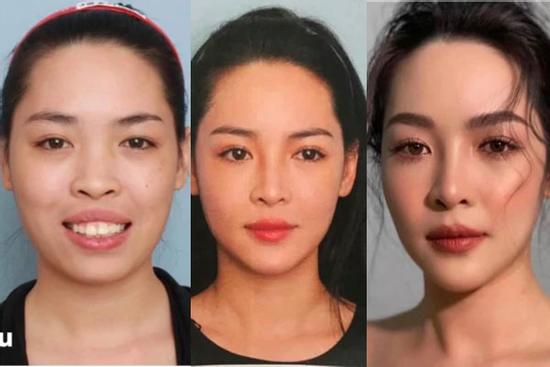 Giật mình nhan sắc hot girl thẩm mỹ Vũ Thanh Quỳnh sau 7 năm