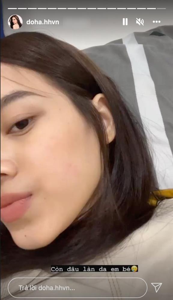 Đôi tay nhăn nhúm của Hoa hậu Đỗ Thị Hà khiến fan sắc đẹp ngã ngửa-5