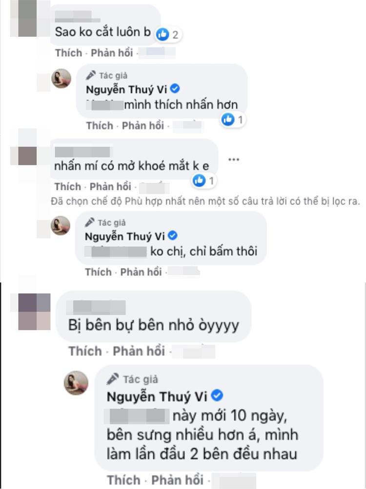 Thúy Vi dao kéo lần thứ n, dân tình soi thẩm mỹ hỏng rồi-4