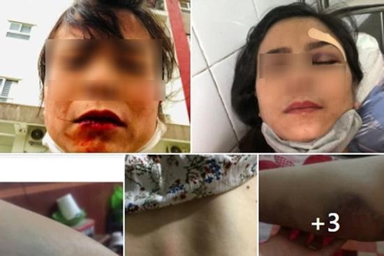 Xôn xao vợ tố chồng đánh đập dã man, dẫn nhân tình về nhà ăn ở