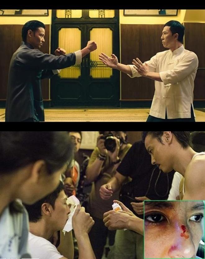 Cao thủ đánh gãy mũi Chân Tử Đan, đá Ngô Kinh hiện sống ra sao?-3