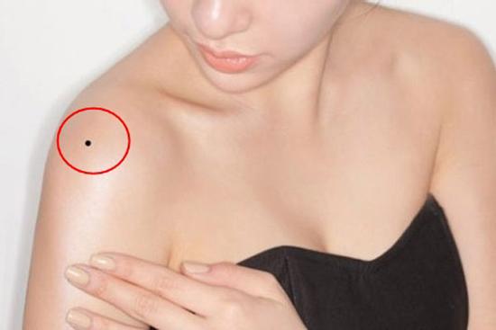 4 nốt ruồi tài lộc, cơ hội trở thành tỷ phú kếch sù sau 1 đêm