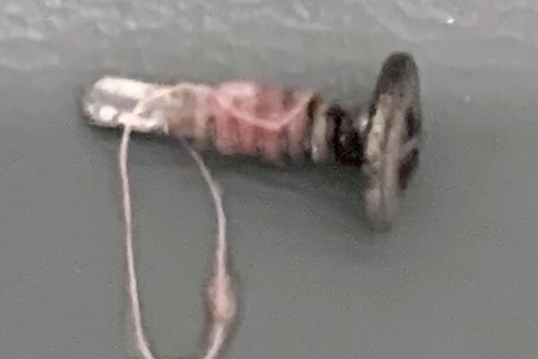 Bé trai 3 tuổi tử vong vì nuốt phải đinh ở trường mầm non-1