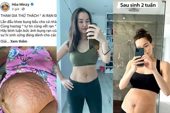 Sao Việt sau sinh: Võ Hạ Trâm rạn chằng chịt - Hà Hồ bụng to như chưa đẻ