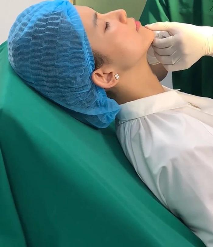 Hoa hậu Hoàn vũ Việt Nam đầu tiên Thùy Lâm công khai tiêm cằm-3