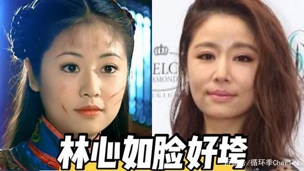 Lâm Tâm Như lão hóa nhanh ở tuổi 45 là do mắc bệnh lạ?-1