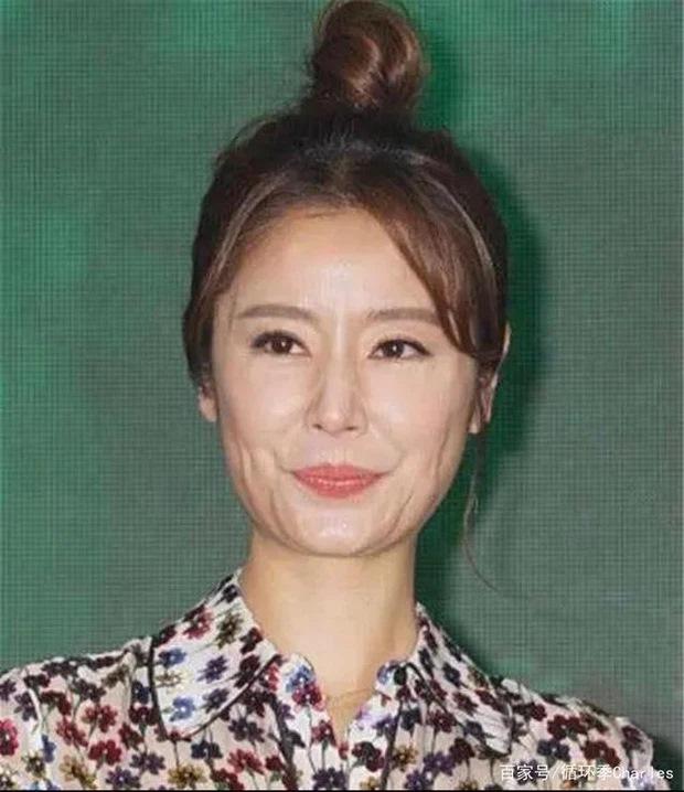 Lâm Tâm Như lão hóa nhanh ở tuổi 45 là do mắc bệnh lạ?-4