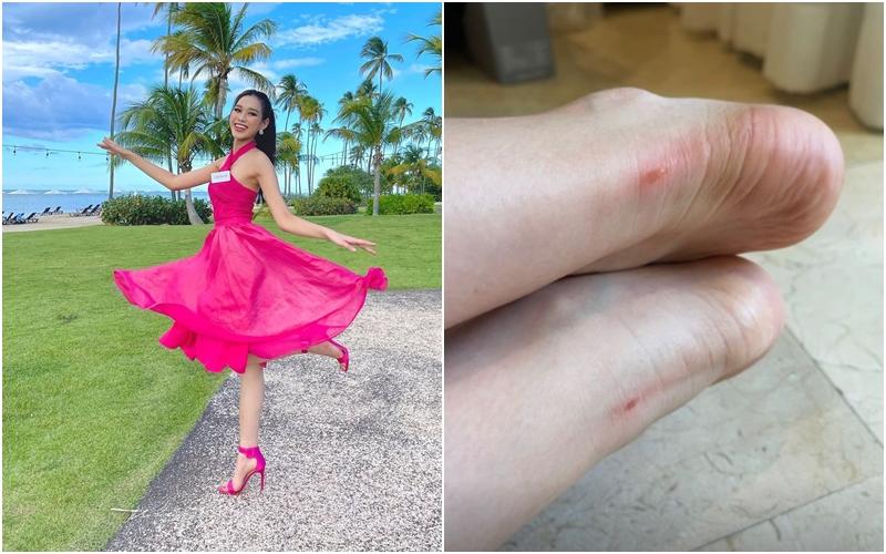 Mỹ nhân Việt trày da, tróc vảy đau đớn vì lênh khênh giày cao gót-2